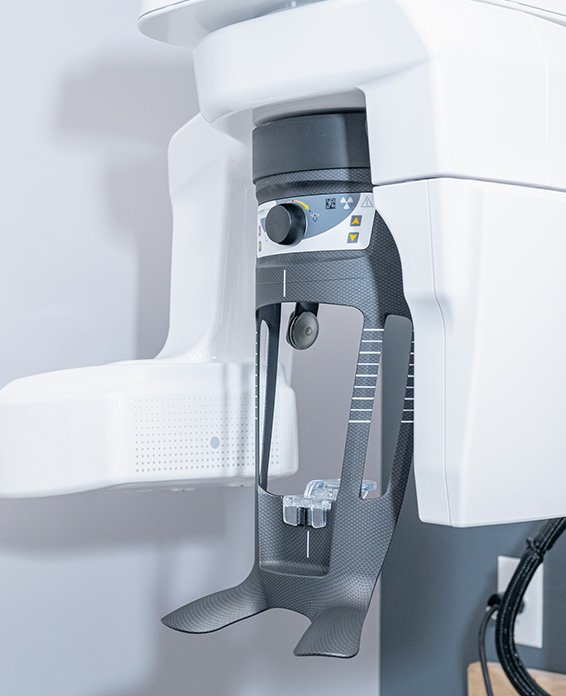 3D Cone Beam CT (CBCT)