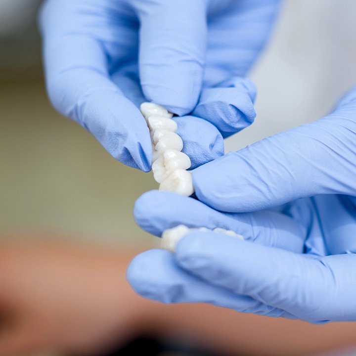 Dental professional showing a dental bridge to a patient