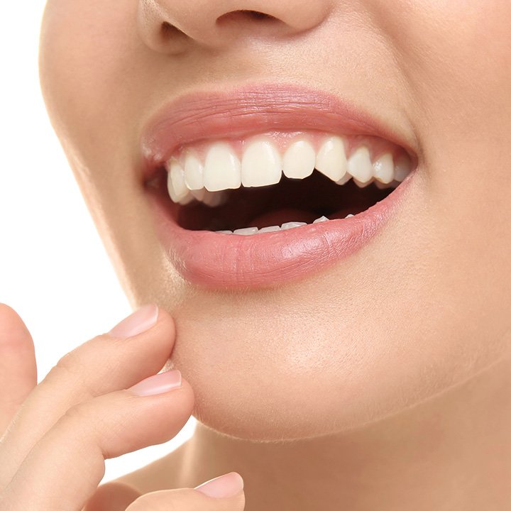 Woman showing improved smile after dental bonding in Stafford, VA